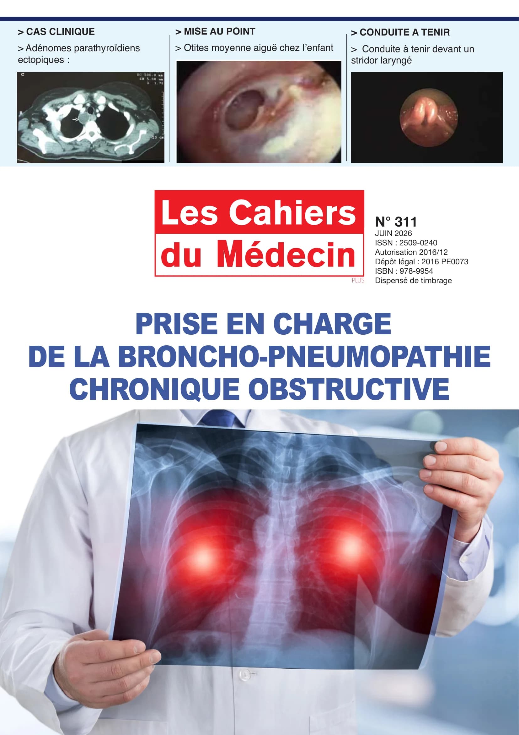 Hypertension artérielle : ce qui change dans les recommandations 2026