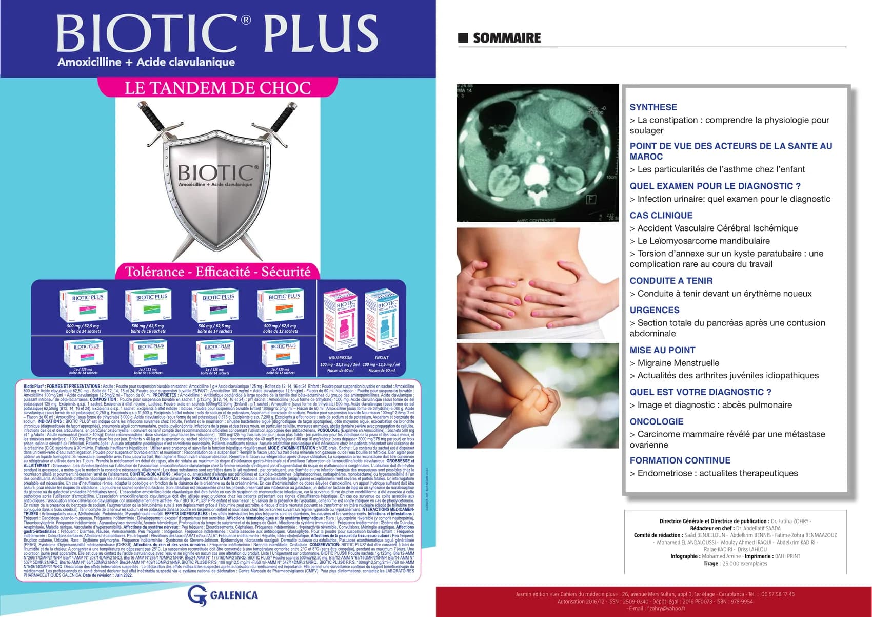 Fibrillation atriale : la place des anticoagulants oraux directs