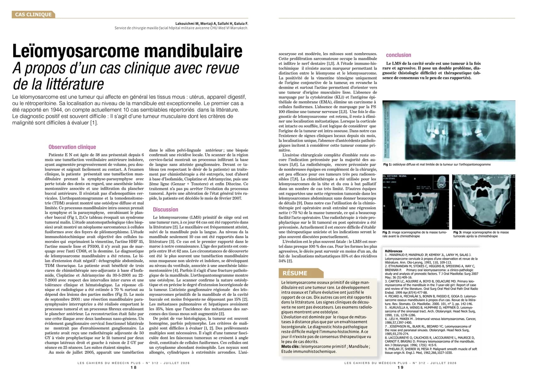Vaccination de l'adulte : le rattrapage, un réflexe à ancrer