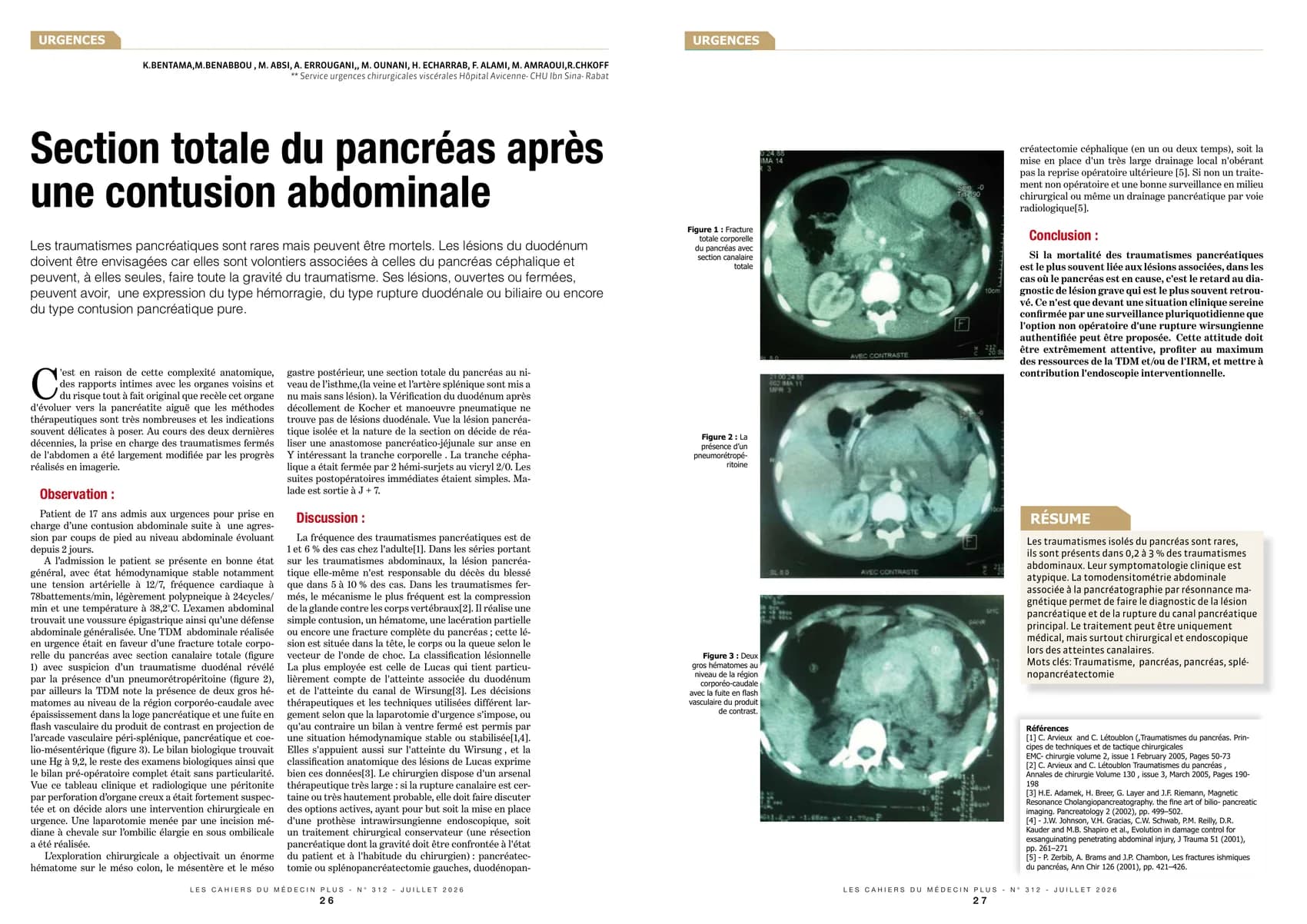 Anticoagulants et AINS : une association à proscrire, mais fréquente